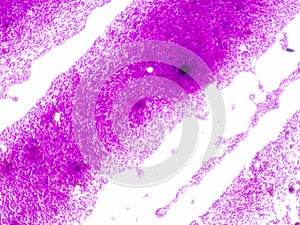 Acinetobacter baumannii