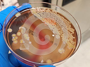 Acinetobacter hemolytic bacterial colonies on agar plate
