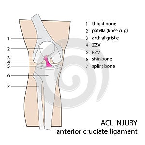 Acl knee injury