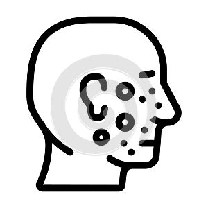 acne facial skin disease line icon vector illustration