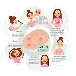 Acne infographics. Causes.