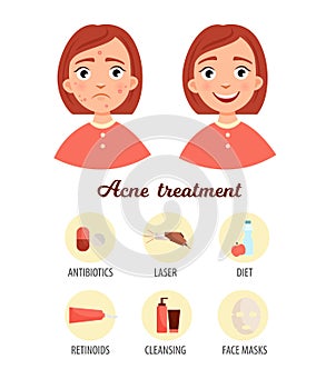 Acne infographics.