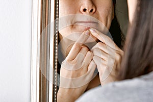 Acne pus, Close up photo of acne prone skin, Woman looking at mirror and hand squeezing her acne cyst. photo
