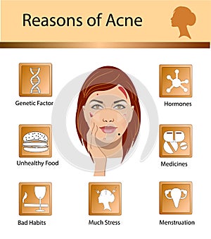 Acne reasons. Skin problems and diseases beauty infographics. Vector illustration. photo