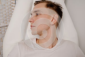 Acne scars on the face