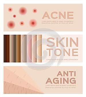 Acne , skin tone and anti aging . 3 banner set