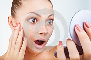 Acne in women photo