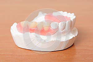 Acrylic denture (False teeth)