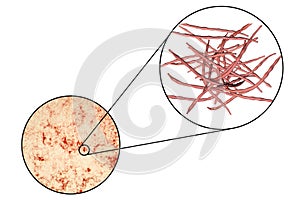 Actinomycetes, gram-positive anaerobic bacteria which resemble fungi