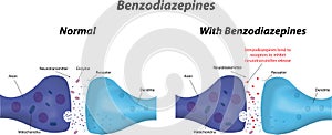 The Action of Benzodiazepines