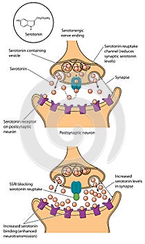 Action of SSRI