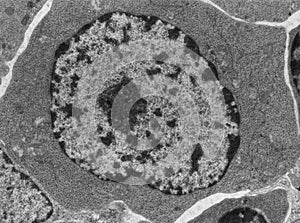 Activated B lymphocyte, TEM photo