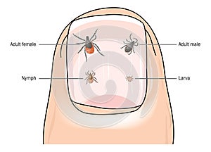 Actual size of tick stages