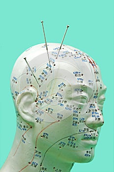 Acupuncture