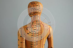 Acupuncture - alternative medicine. Human model with needles in shoulder against grey background, back view
