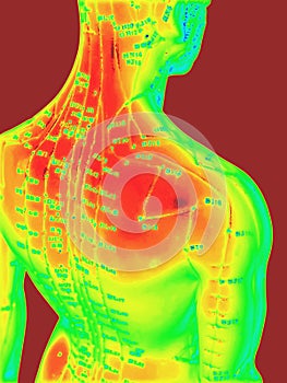 Acupuncture Concept