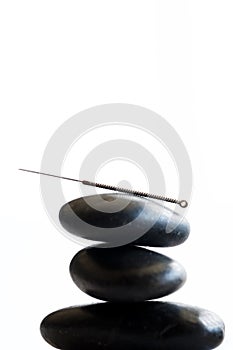 Acupuncture needle