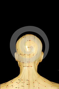 Acupuncture points