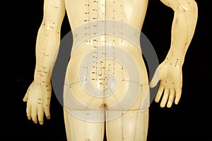 Acupuncture points