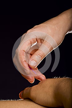 Acupuncture treatment to male hand