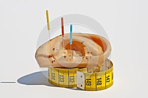 Acupuncture for weight loss photo