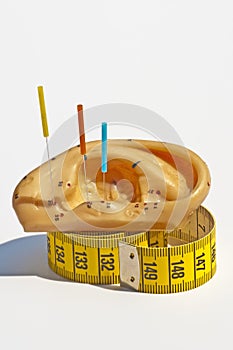 Acupuncture for weight loss photo