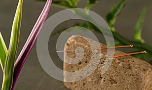 Acupuncturist doctor`s office. Steel needle for treatment of pain