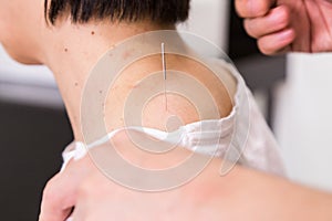 Acupuncturist needle pricking into skin, with shallow depth of f