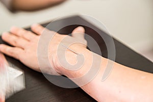 Acupuncturist needle pricking into skin with shallow depth of field