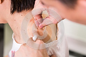 Acupuncturist pricking needle into skin, with shallow depth of f
