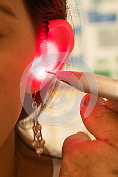 Acupunture in ear with laser