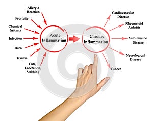 Acute and Chronic Inflammation