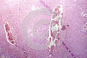 Acute hepatic congestion, light micrograph