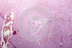 Acute hepatic congestion, light micrograph