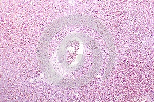 Acute hepatic congestion, light micrograph