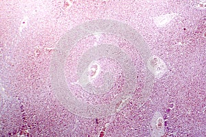 Acute hepatic congestion, light micrograph