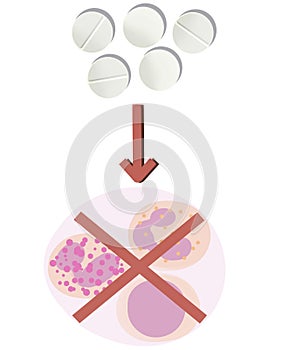 Immunosuppression and corticosteroids photo