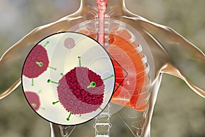 Adenovirus infection, adenoviruses in human lungs