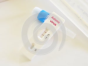 Adenovirus positive test result photo