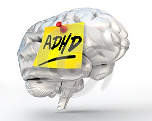 Adhd yellow note on brain