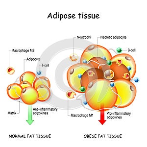 Adipocytes, obesity, and inflammation. normal, and obese adipose tissue photo