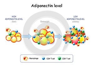 Adipocytes in the fat tissue,  Macrophage and T-cell in adipose tissue with inflammation photo