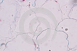 Adipose tissue/Body fat/Simply fat is a loose connective tissue under the microscopic.