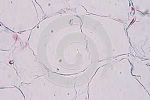 Adipose tissue/Body fat/Simply fat is a loose connective tissue under the microscopic.