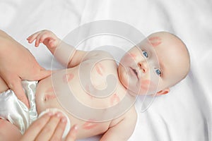 Adorable child with red kisses on the skin sitting on white background, Mother cleaning up and wipes body baby. top view