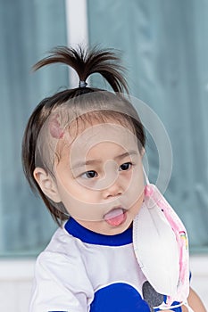 Adorable little child girl with big capillary strawberry hemangiomas red birthmark on head refuses to wear medical face mask that