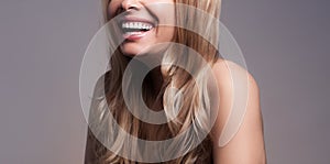 Adult beautiful blond woman with white veneers on the teeth.