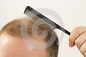 Adult man hand holding comb on bald head
