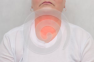 Adult woman on a white background which has a thyroid gland, nodes in the thyroid gland, close-up, endocrine system photo