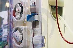 Advanced dialysis equipment in hospital